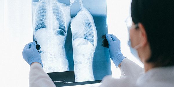 Roentgenbild Lunge Pexels    Eefe